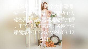 (sex)20230727_小西瓜黑白配_57377056